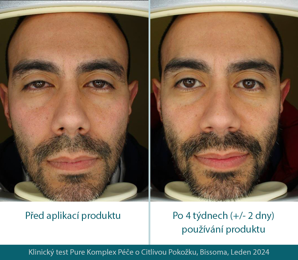 3. foto